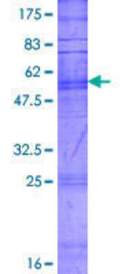 12.5% SDS-PAGE Stained with Coomassie Blue.
