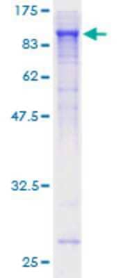 12.5% SDS-PAGE Stained with Coomassie Blue.