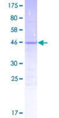 SDS-Page: Recombinant Human C14orf181 Protein [H00400223-P01] - 12.5% SDS-PAGE Stained with Coomassie Blue.