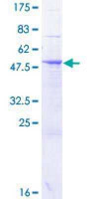 12.5% SDS-PAGE Stained with Coomassie Blue.