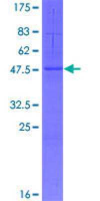 12.5% SDS-PAGE Stained with Coomassie Blue.