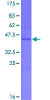 12.5% SDS-PAGE Stained with Coomassie Blue.