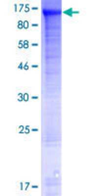 SDS-Page: Recombinant Human FAM190A Protein [H00401145-P01] - 12.5% SDS-PAGE Stained with Coomassie Blue.