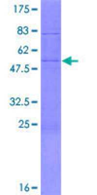 12.5% SDS-PAGE Stained with Coomassie Blue.