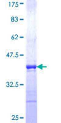 12.5% SDS-PAGE Stained with Coomassie Blue.