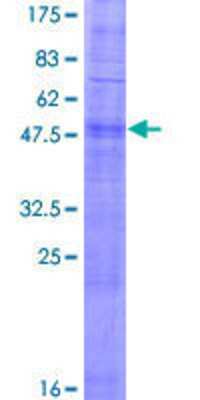 12.5% SDS-PAGE Stained with Coomassie Blue.