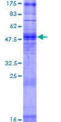 12.5% SDS-PAGE Stained with Coomassie Blue.