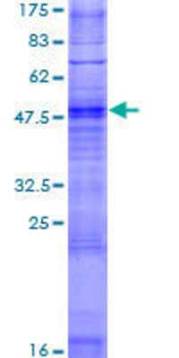 12.5% SDS-PAGE Stained with Coomassie Blue.