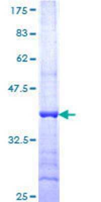 12.5% SDS-PAGE Stained with Coomassie Blue.