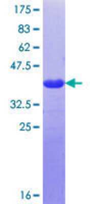 12.5% SDS-PAGE Stained with Coomassie Blue.
