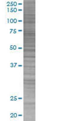 BRCC2 transfected lysate.