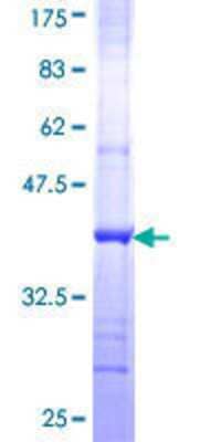 12.5% SDS-PAGE Stained with Coomassie Blue.