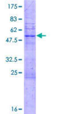 12.5% SDS-PAGE Stained with Coomassie Blue.