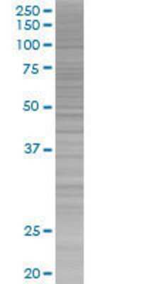 LOC440456 transfected lysate.