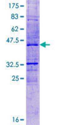 12.5% SDS-PAGE Stained with Coomassie Blue.