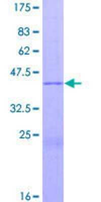 12.5% SDS-PAGE Stained with Coomassie Blue.