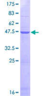 12.5% SDS-PAGE Stained with Coomassie Blue.
