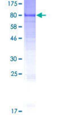 12.5% SDS-PAGE Stained with Coomassie Blue.