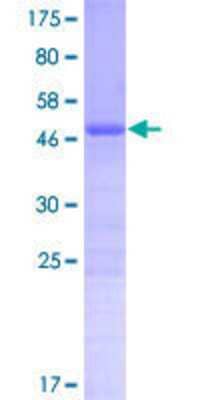 12.5% SDS-PAGE Stained with Coomassie Blue.