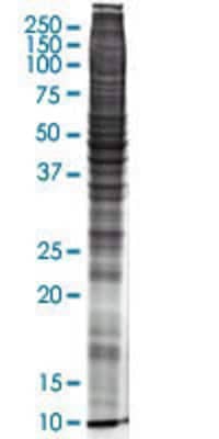 Other SKOV-3 Nuclear Cell Lysate