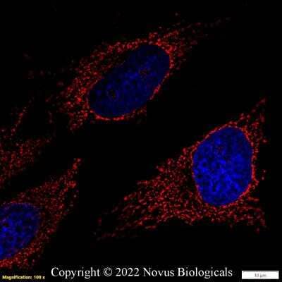 Immunocytochemistry/Immunofluorescence: rRNA Antibody (Y10b) [Biotin] [NB100-662B] - HeLa cells were fixed and permeabilized for 10 minutes with -20C MeOH.  The cells were incubated with rRNA Antibody [Y10b] conjugated to Biotin (NB100-662B) at 5ug/ml overnight at 4C and detected with Streptavidin conjugated to DyLight 550.  Nuclei were counterstained with DAPI (Blue).  Cells were imaged using a 100X objective and digitally deconvolved.