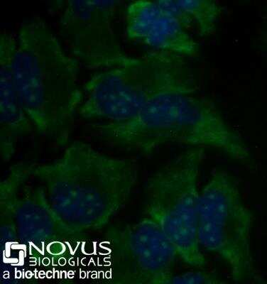 Immunocytochemistry/Immunofluorescence: rRNA Antibody (Y10b) [DyLight 488] [NB100-662G] - HeLa cells were fixed and permeabilized for 10 minutes using -20C MeOH.  The cells were incubated with anti-rRNA (Y10b) conjugated to DyLight 488 [NB100-662G] at 5ug/ml for 1 hour at room temperature.  Nuclei were counterstained with DAPI (Blue).  Cells were imaged using a 40X objective.