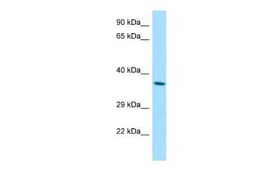 Western Blot: retinol dehydrogenase 8 (all trans) Antibody [NBP3-09458] - Western blot analysis of retinol dehydrogenase 8 (all trans) in A549 Whole Cell as a positive control. Antibody dilution at 1.0 ug/ml