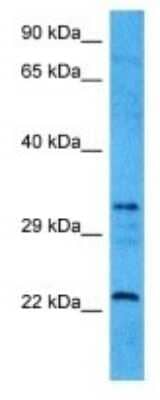 Western Blot: retinol dehydrogenase 8 (all trans) Antibody [NBP3-10040] - Western blot analysis of retinol dehydrogenase 8 (all trans) in Human HCT116 Whole Cell lysates. Antibody dilution at 1ug/ml