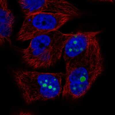 Immunocytochemistry/Immunofluorescence: sFRP-1 Antibody [NBP2-57336] - Staining of human cell line SK-MEL-30 shows localization to nucleoli.