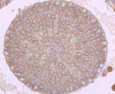 Immunohistochemistry-Paraffin: sFRP-1 Antibody [NBP2-89148] - Analysis of paraffin-embedded rat testis tissue using anti-SFRP1 antibody. Counter stained with hematoxylin.