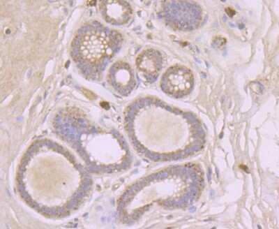 Immunohistochemistry-Paraffin: sFRP-1 Antibody [NBP2-89148] - Immunohistochemical analysis of paraffin-embedded human breast tissue using anti-sFRP-1 antibody. Counter stained with hematoxylin.