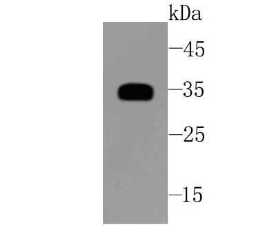 Western Blot: sFRP-1 Antibody (JA11-68) [NBP2-67139] - Analysis of SFRP1 on human kidney tissue lysates using anti-SFRP1 antibody at 1/500 dilution.