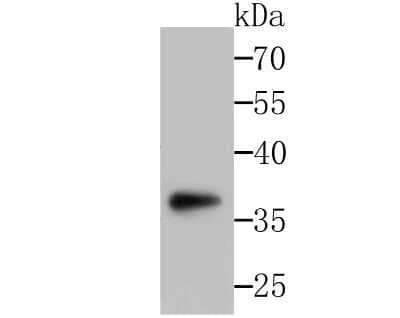 Western Blot: sFRP-1 Antibody [NBP2-89148] - Analysis of SFRP1 on SH-SY-5Y cells lysates using anti-SFRP1 antibody at 1/500 dilution.