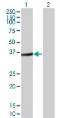 Western Blot: sFRP-3/FRZB Antibody (1H8) [H00002487-M05] - Analysis of FRZB expression in transfected 293T cell line by FRZB monoclonal antibody (M05), clone 1H8. Lane 1: FRZB transfected lysatE (36.254 KDa). Lane 2: Non-transfected lysate.