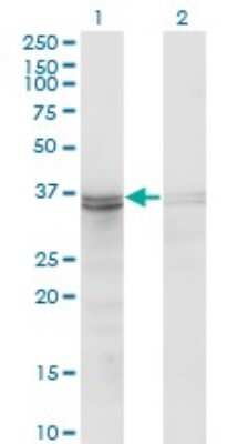 Western Blot: sFRP-3/FRZB Antibody (3F4) [H00002487-M06] - Analysis of FRZB expression in transfected 293T cell line by FRZB monoclonal antibody (M06), clone 3F4. Lane 1: FRZB transfected lysatE (36.3 KDa). Lane 2: Non-transfected lysate.