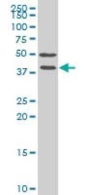 Western Blot: sFRP-3/FRZB Antibody (4E5) [H00002487-M02] - FRZB monoclonal antibody (M02), clone 4E5 Analysis of FRZB expression in Hela S3 NE.