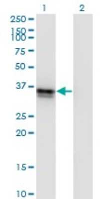 Western Blot: sFRP-3/FRZB Antibody (4F7) [H00002487-M01] - Analysis of FRZB expression in transfected 293T cell line by FRZB monoclonal antibody (M01), clone 4F7.Lane 1: FRZB transfected lysate(36.3 KDa).Lane 2: Non-transfected lysate.