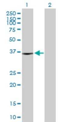 Western Blot: sFRP-3/FRZB Antibody [H00002487-D01P] - Analysis of FRZB expression in transfected 293T cell line by FRZB polyclonal antibody.Lane 1: FRZB transfected lysate(36.30 KDa).Lane 2: Non-transfected lysate.