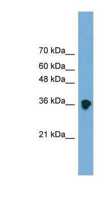 Western Blot: sFRP-3/FRZB Antibody [NBP1-79552] - Titration: 0.2-1 ug/ml, Positive Control: Transfected 293T.