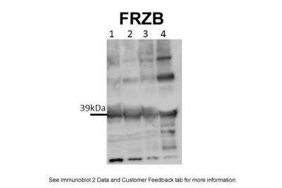 Western Blot: sFRP-3/FRZB Antibody [NBP1-79552] - Titration: 0.4 ug/ml Positive Control: human synovium patient.