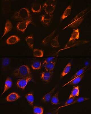 Immunocytochemistry/Immunofluorescence: sFRP-4 Antibody (7Z6Q1) [NBP3-16352] - Immunofluorescence analysis of NIH-3T3 cells using sFRP-4 Rabbit mAb (NBP3-16352) at dilution of 1:100 (40x lens). Blue: DAPI for nuclear staining.