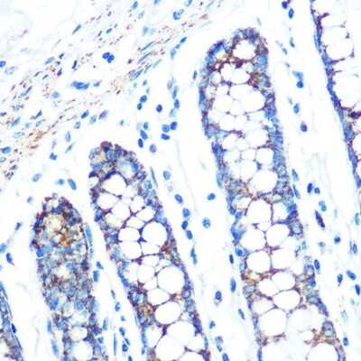 Immunohistochemistry-Paraffin: sFRP-4 Antibody (7Z6Q1) [NBP3-16352] - Immunohistochemistry of paraffin-embedded human colon using sFRP-4 Rabbit mAb (NBP3-16352) at dilution of 1:100 (40x lens).Perform microwave antigen retrieval with 10 mM PBS buffer pH 7.2 before commencing with IHC staining protocol.