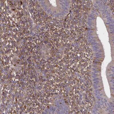 Immunohistochemistry-Paraffin: sFRP-4 Antibody [NBP1-81866] - Staining of human endometrium shows moderate secreted positivity in cells in endometrial stroma.