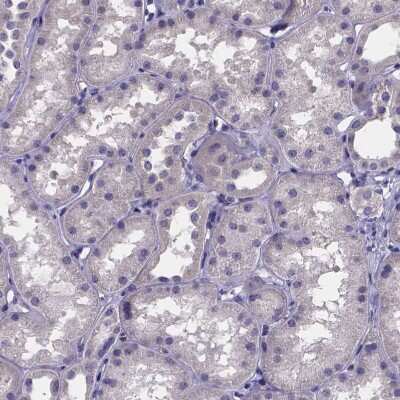 Immunohistochemistry-Paraffin: sFRP-4 Antibody [NBP1-81866] - Staining of human kidney shows no positivity in cells in tubules as expected.