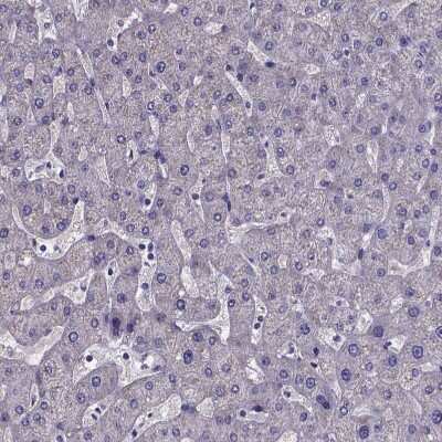 Immunohistochemistry-Paraffin: sFRP-4 Antibody [NBP1-81866] - Staining of human liver shows no positivity in hepatocytes as expected.