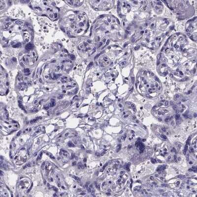 Immunohistochemistry-Paraffin: sFRP-4 Antibody [NBP1-81866] - Staining of human placenta shows no positivity in trophoblastic cells as expected.