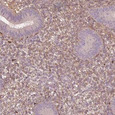 Immunohistochemistry-Paraffin: sFRP-4 Antibody [NBP2-38632] - Staining of human endometrium shows moderate secreted positivity in cells in endometrial stroma.