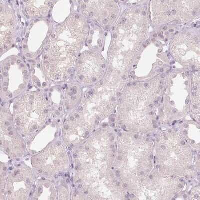 Immunohistochemistry-Paraffin: sFRP-4 Antibody [NBP2-38632] - Staining of human kidney shows no positivity in cells in tubules as expected.