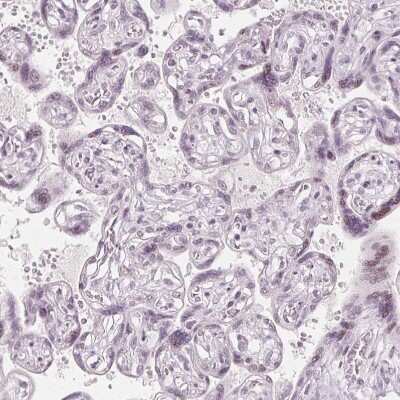 Immunohistochemistry-Paraffin: sFRP-4 Antibody [NBP2-38632] - Staining of human placenta shows no positivity in trophoblastic cells as expected.