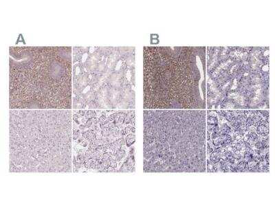 Immunohistochemistry-Paraffin: sFRP-4 Antibody [NBP2-38632] - Staining of human endometrium, kidney, liver and placenta using Anti-SFRP4 antibody (A) shows similar protein distribution across tissues to independent antibody  (B).